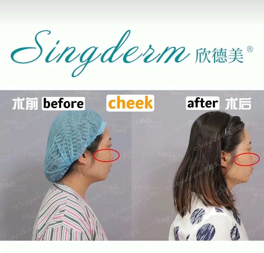 cheek.jpg